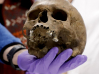 ALbert Schweitzer ziekenhuis scant botten van middeleeuwse man Dordrecht